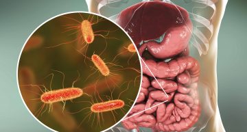 How a Healthy Gut Bacteria and Weight loss