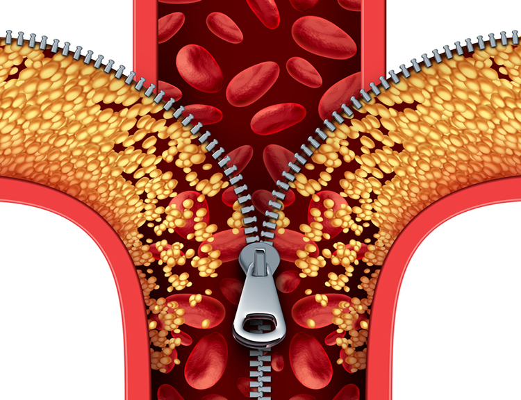 Cholesterol