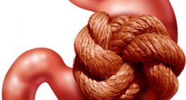 How Much Poop Is Trapped In Your Body?