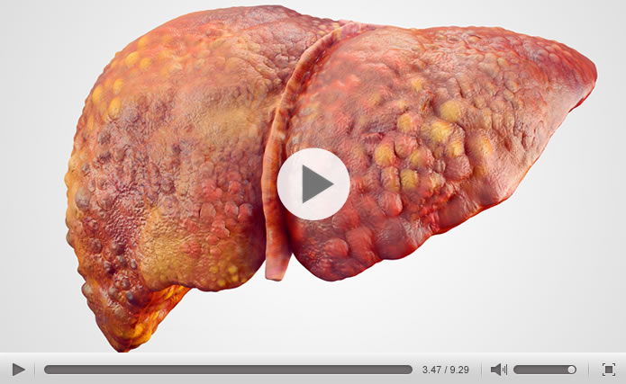 Liver2