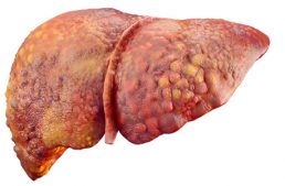 What’s the Biggest Cause of Fatty Liver Disease?