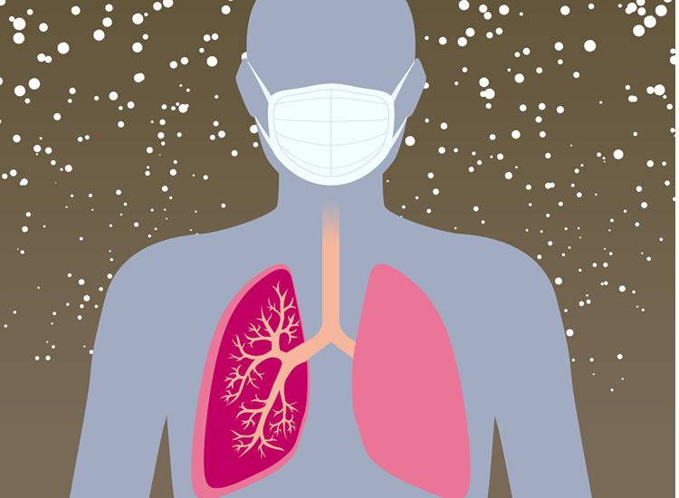 Particulate Matter
