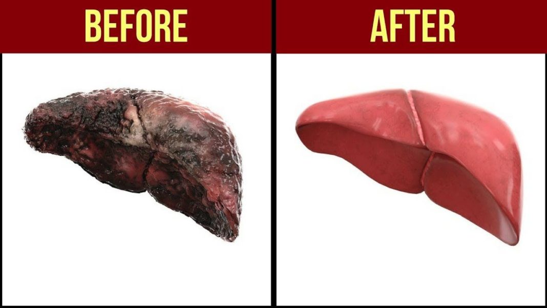 What To Expect During And After Your Liver Cleanse